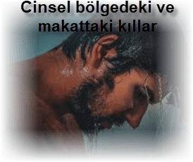 Cinsel bölgedeki ve makattaki kıllar gusle engel olur mu ? 2 Cinsel bolgedeki ve makattaki killar