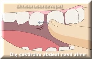 Dis cektirdim abdest nasil alinir