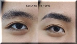 Kas Alma Kil Yolma