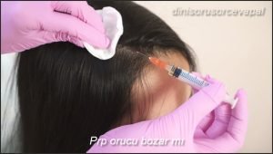 Prp orucu bozar mi