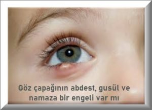 Goz capaginin abdest gusul ve namaza bir engeli var mi